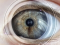 Hiperfocal